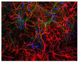 Immunocytochemistry/Immunofluorescence: GFAP Antibody (5C10) [NBP1-05197] - Mixed neuron-glial cultures stained with NBP1-05197, and chicken polyclonal antibody to neurofilament NF-L NBP1-05219 (green). The GFAP antibody stains the network of astrocytes in these cultures, while the NF-L antibody stains neurons and their processes. The blue channel shows the localization of DNA.