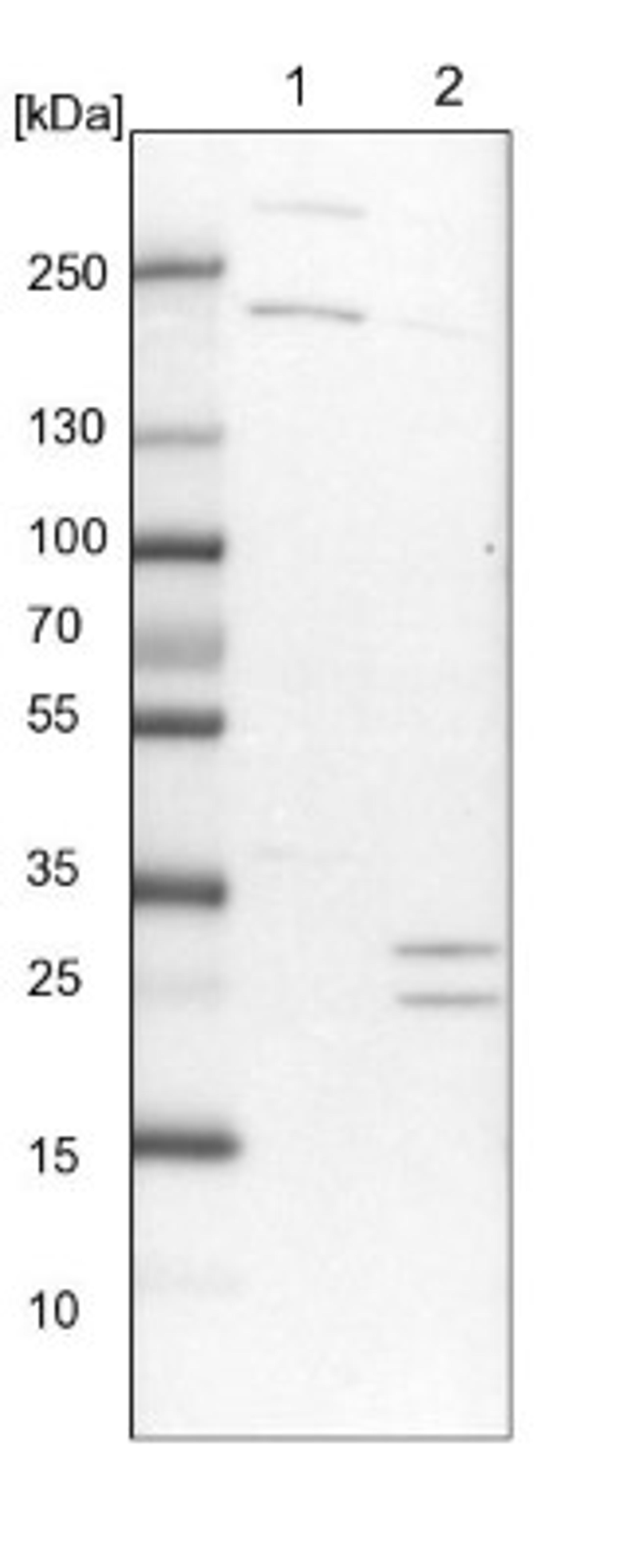 Western Blot: Tollip Antibody [NBP1-81597] - Lane 1: NIH-3T3 cell lysate (Mouse embryonic fibroblast cells)<br/>Lane 2: NBT-II cell lysate (Rat Wistar bladder tumour cells)