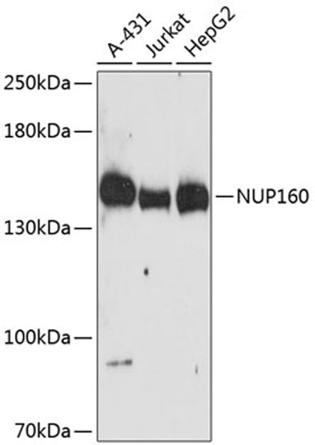 Western blot - NUP160 antibody (A13080)