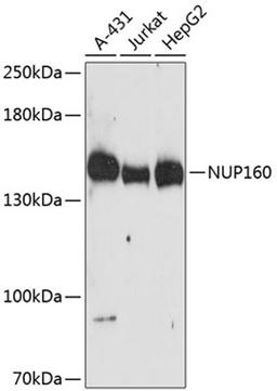 Western blot - NUP160 antibody (A13080)