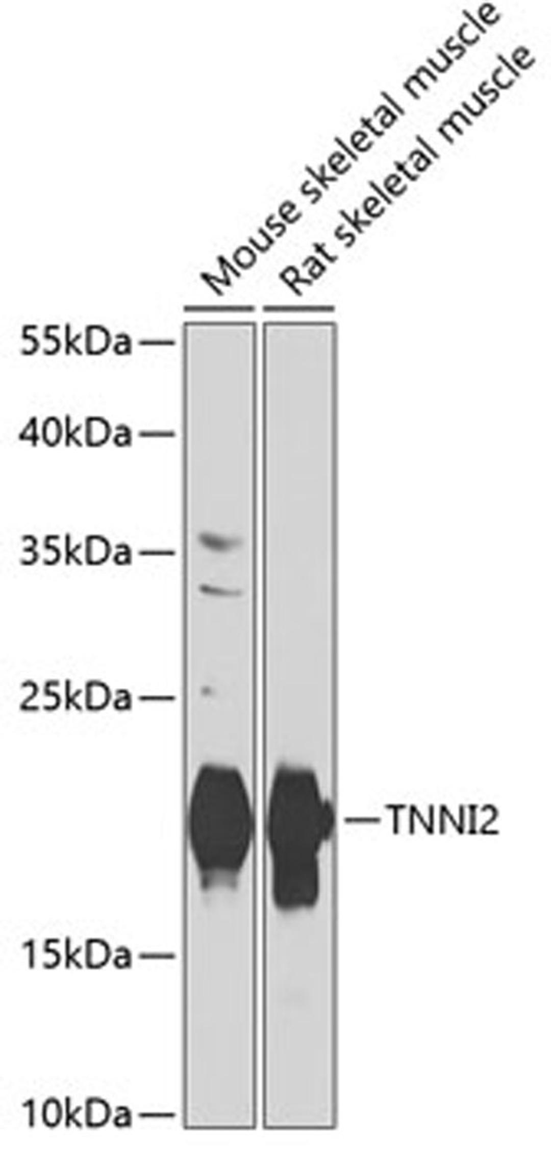 Western blot - TNNI2 antibody (A7937)