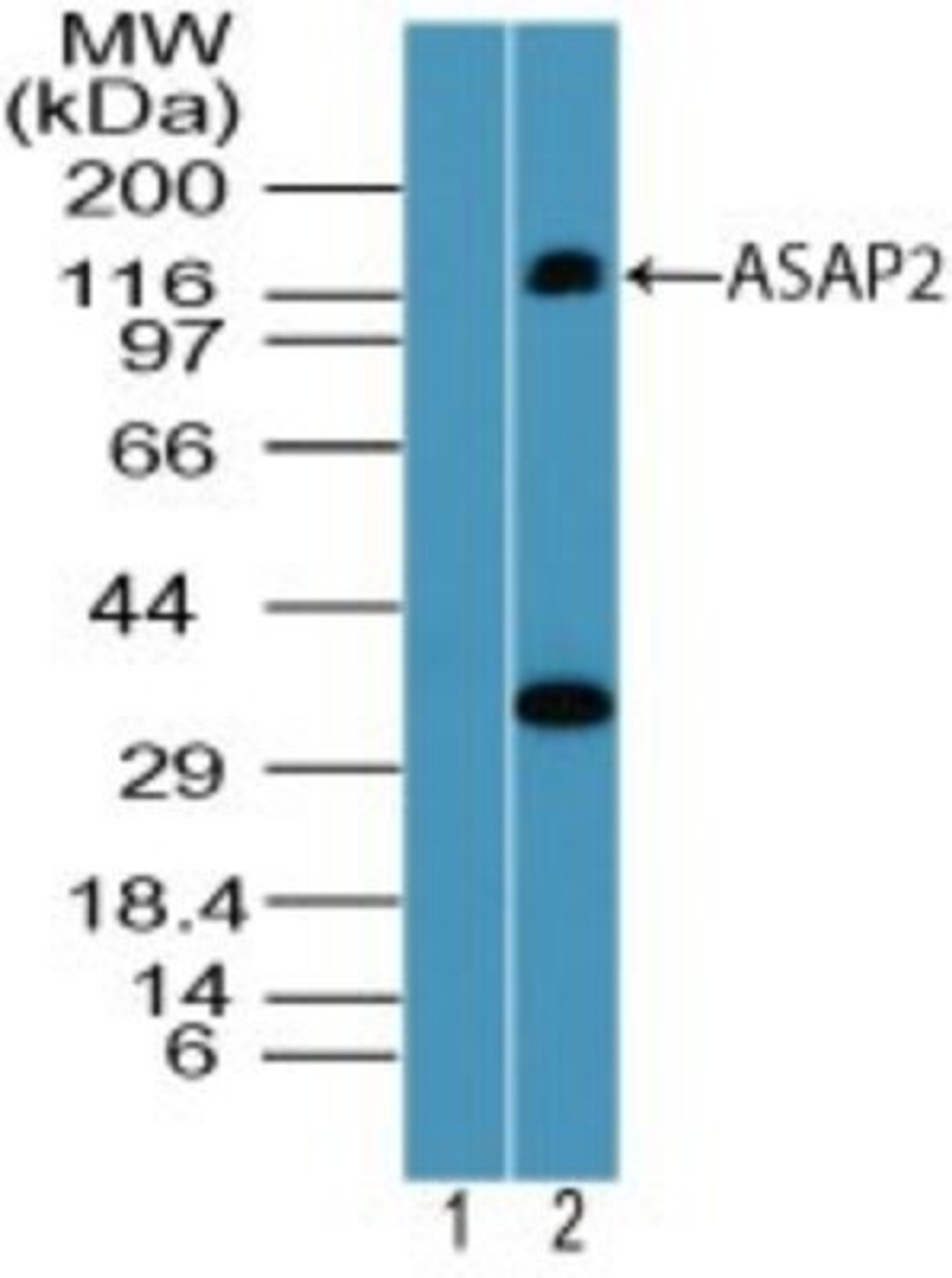 Western Blot: PAG3 Antibody [NBP2-24614] - Analysis of ASAP2 in human brain lysate using 1) preimmune sera at 1:5000 and 2) protein A purified this antibody. 1.0 ug/ml.