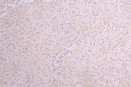 IHC image of CSB-RA010327MA1HU diluted at 1:100 and staining in paraffin-embedded human Liver tissue performed on a Leica BondTM system. After dewaxing and hydration, antigen retrieval was mediated by high pressure in a citrate buffer (pH 6.0). Section was blocked with 10% normal goat serum 30min at RT. Then primary antibody (1% BSA) was incubated at 4°C overnight. The primary is detected by a Goat anti-Human IgG labeled by HRP and visualized using 0.05% DAB.