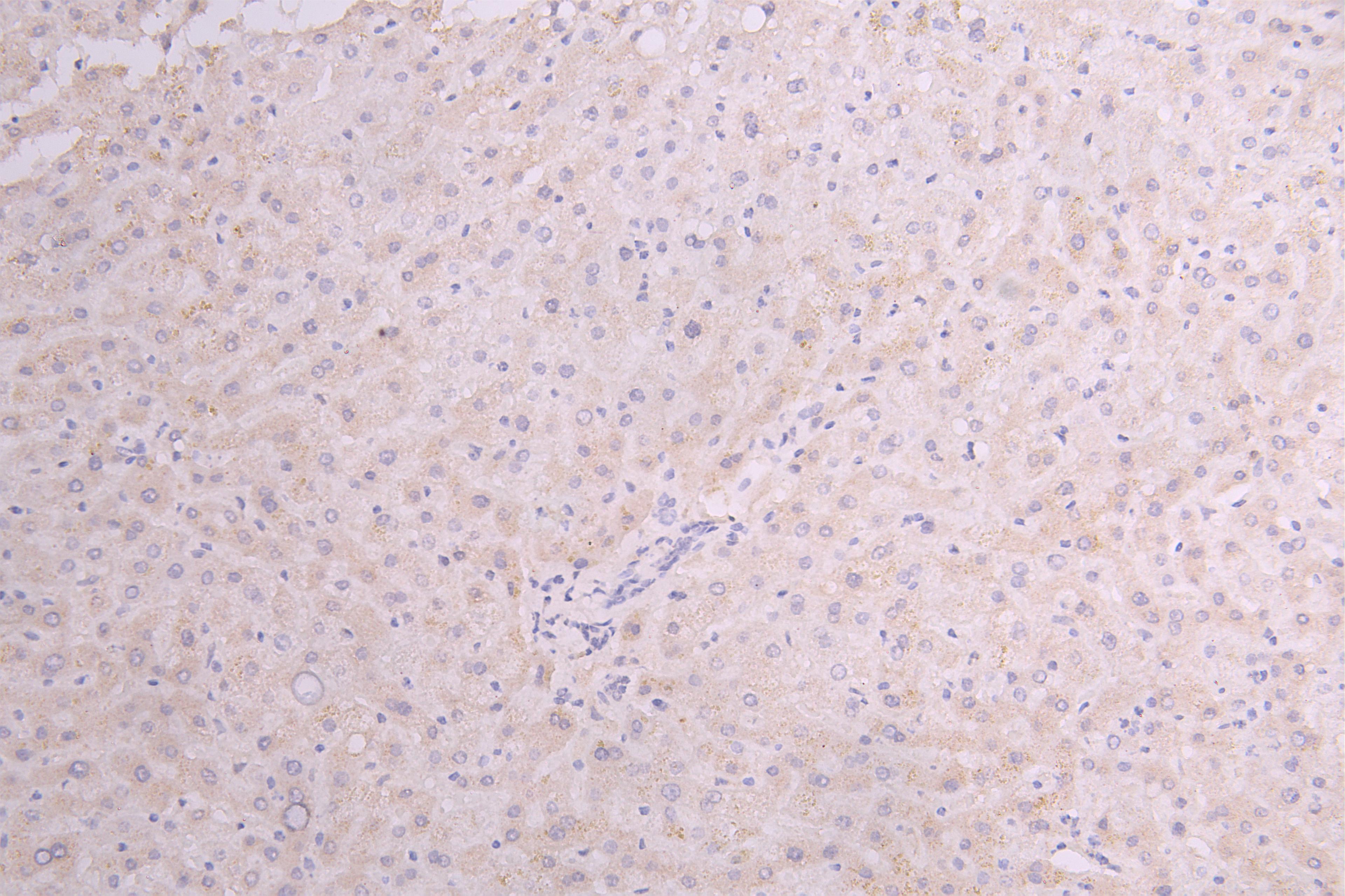 IHC image of CSB-RA010327MA1HU diluted at 1:100 and staining in paraffin-embedded human Liver tissue performed on a Leica BondTM system. After dewaxing and hydration, antigen retrieval was mediated by high pressure in a citrate buffer (pH 6.0). Section was blocked with 10% normal goat serum 30min at RT. Then primary antibody (1% BSA) was incubated at 4°C overnight. The primary is detected by a Goat anti-Human IgG labeled by HRP and visualized using 0.05% DAB.