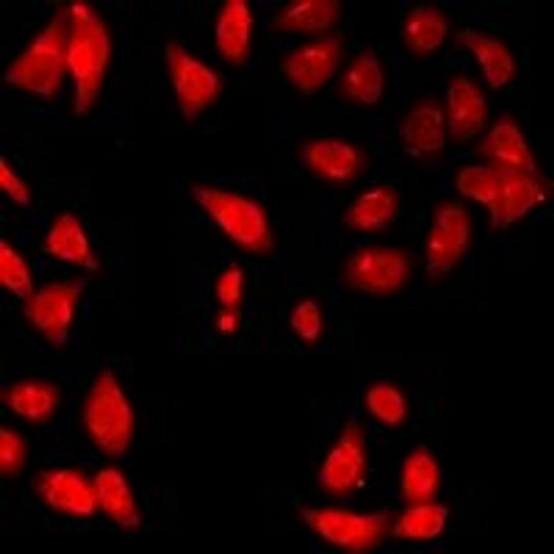 Immunofluorescent analysis of HeLa cells using DNASE1 antibody