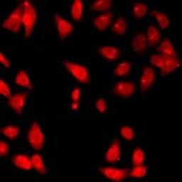 Immunofluorescent analysis of HeLa cells using DNASE1 antibody