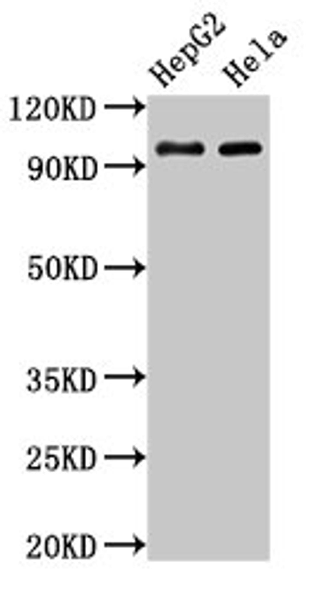 Western Blot. Positive WB detected in: HepG2 whole cell lysate, Hela whole cell lysate. All lanes: ACO1 antibody at 3µg/ml. Secondary. Goat polyclonal to rabbit IgG at 1/50000 dilution. Predicted band size: 99 kDa. Observed band size: 99 kDa