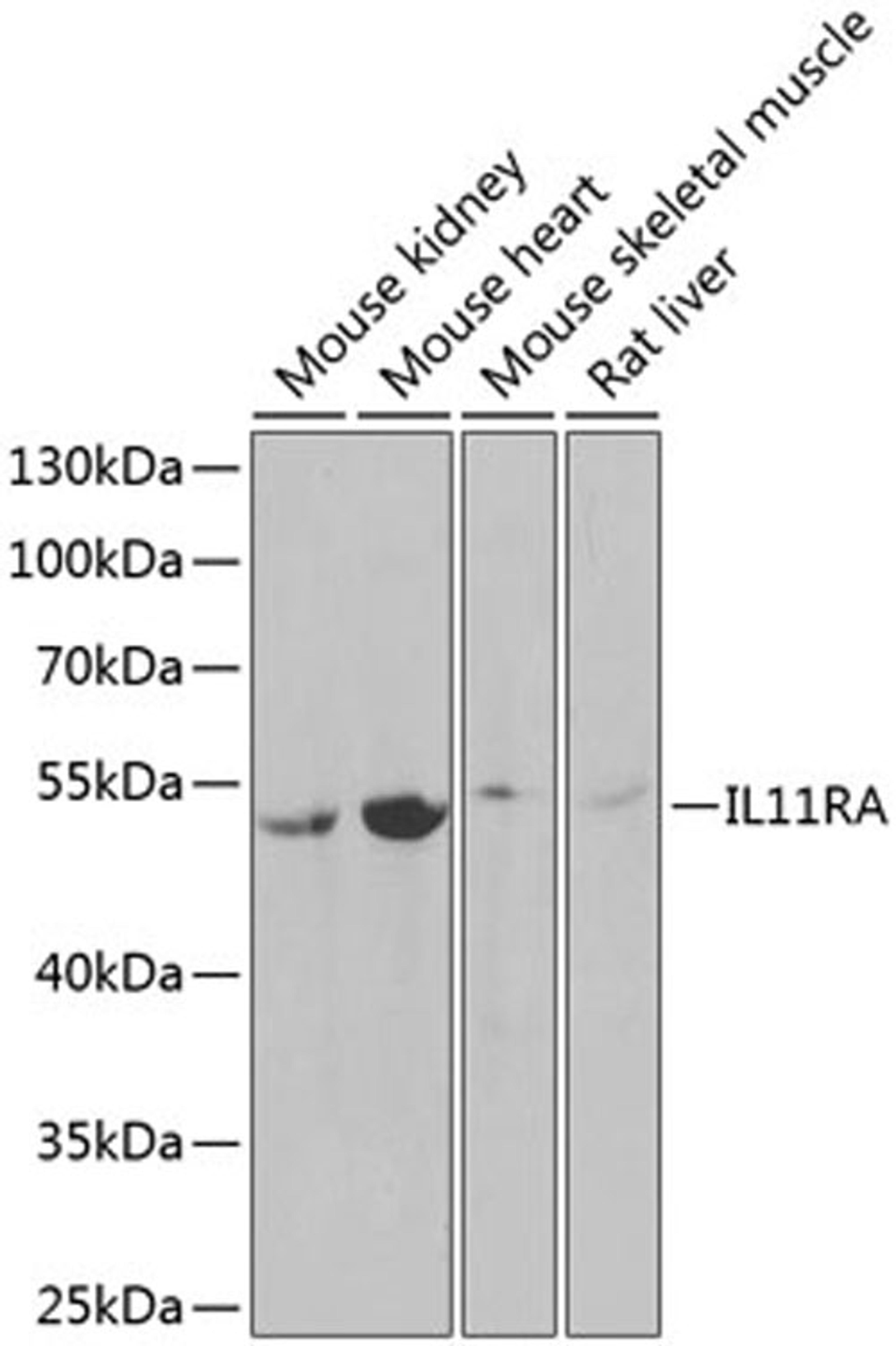 Western blot - IL11RA Antibody (A6627)