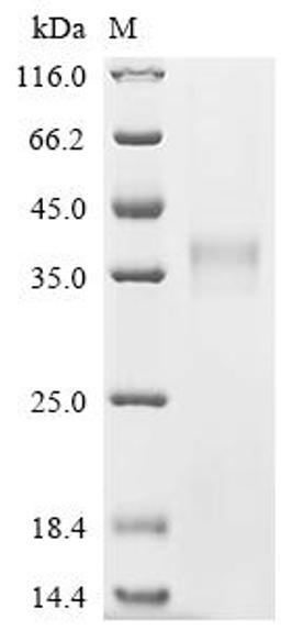(Tris-Glycine gel) Discontinuous SDS-PAGE (reduced) with 5% enrichment gel and 15% separation gel.