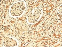 Immunohistochemistry-Paraffin: VPS41 Antibody [NB100-2425] - (4ug/ml) staining of paraffin embedded Human Kidney. Steamed antigen retrieval with citrate buffer pH 6, HRP-staining. Similar results were obtained after antigen retrieval at pH9.