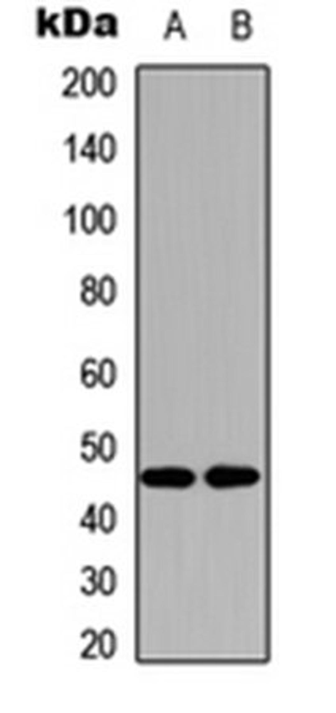 Western blot analysis of HEK293T (Lane 1), NIH3T3 (Lane 2) whole cell lysates using GPR172B antibody