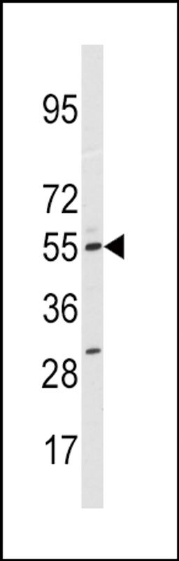 Western blot analysis of anti-CYP11A1 Antibody in HepG2 cell line lysates (35ug/lane).