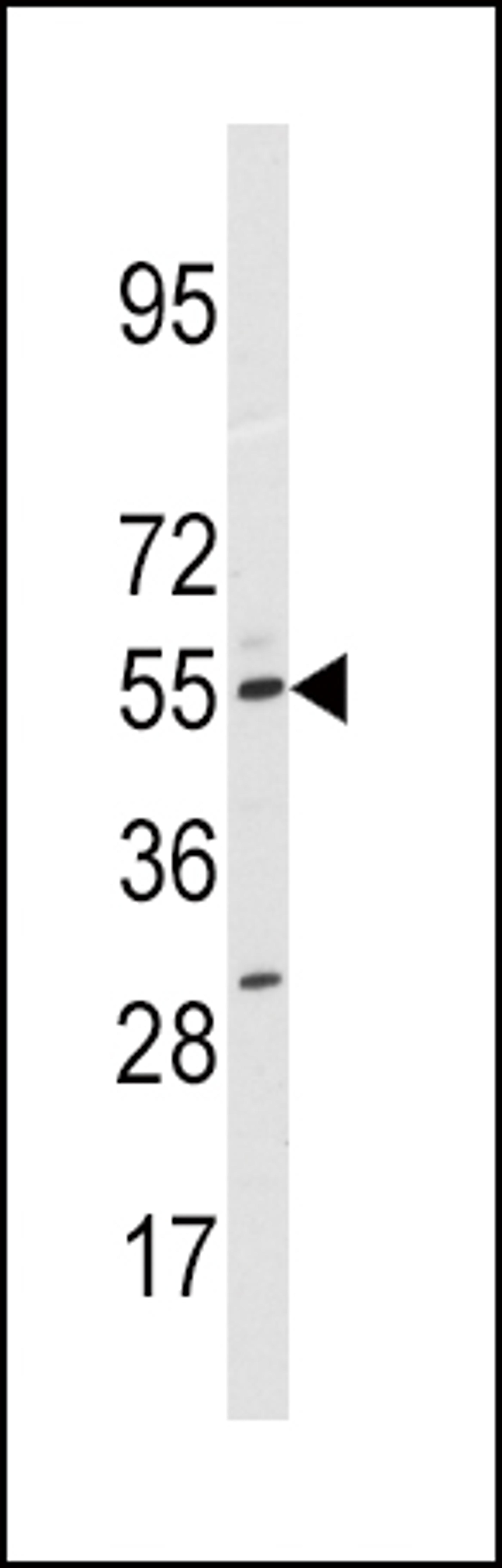 Western blot analysis of anti-CYP11A1 Antibody in HepG2 cell line lysates (35ug/lane).