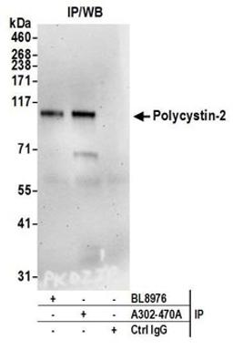 Detection of human Polycystin-2 by western blot of immunoprecipitates.