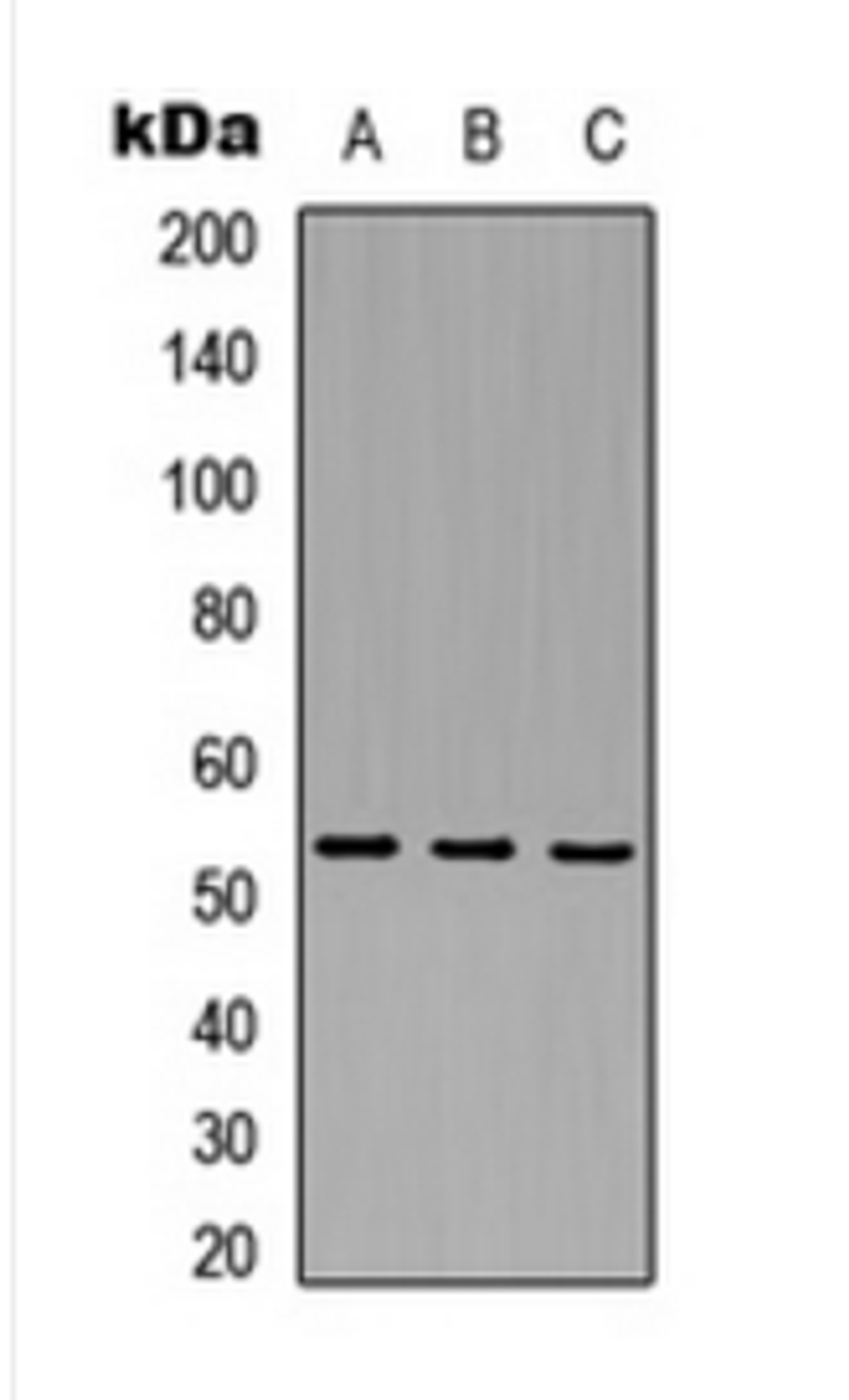 Western blot analysis of HEK293T (Lane 1), mouse brain (Lane 2), rat liver (Lane 3) whole cell lysates using MAP3K8 antibody