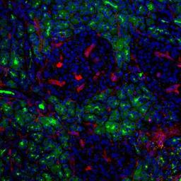 Immunocytochemistry/Immunofluorescence: ST8 alpha-2,8-Sialyltransferase 8A/ST8SIA1/Ganglioside GD3 Antibody (MB3.6) [NBP2-29826] - Ganglioside GD3 (NBP2-29826; red) and GP2 (green) on human pancreas, 200x. Image from verified customer review.