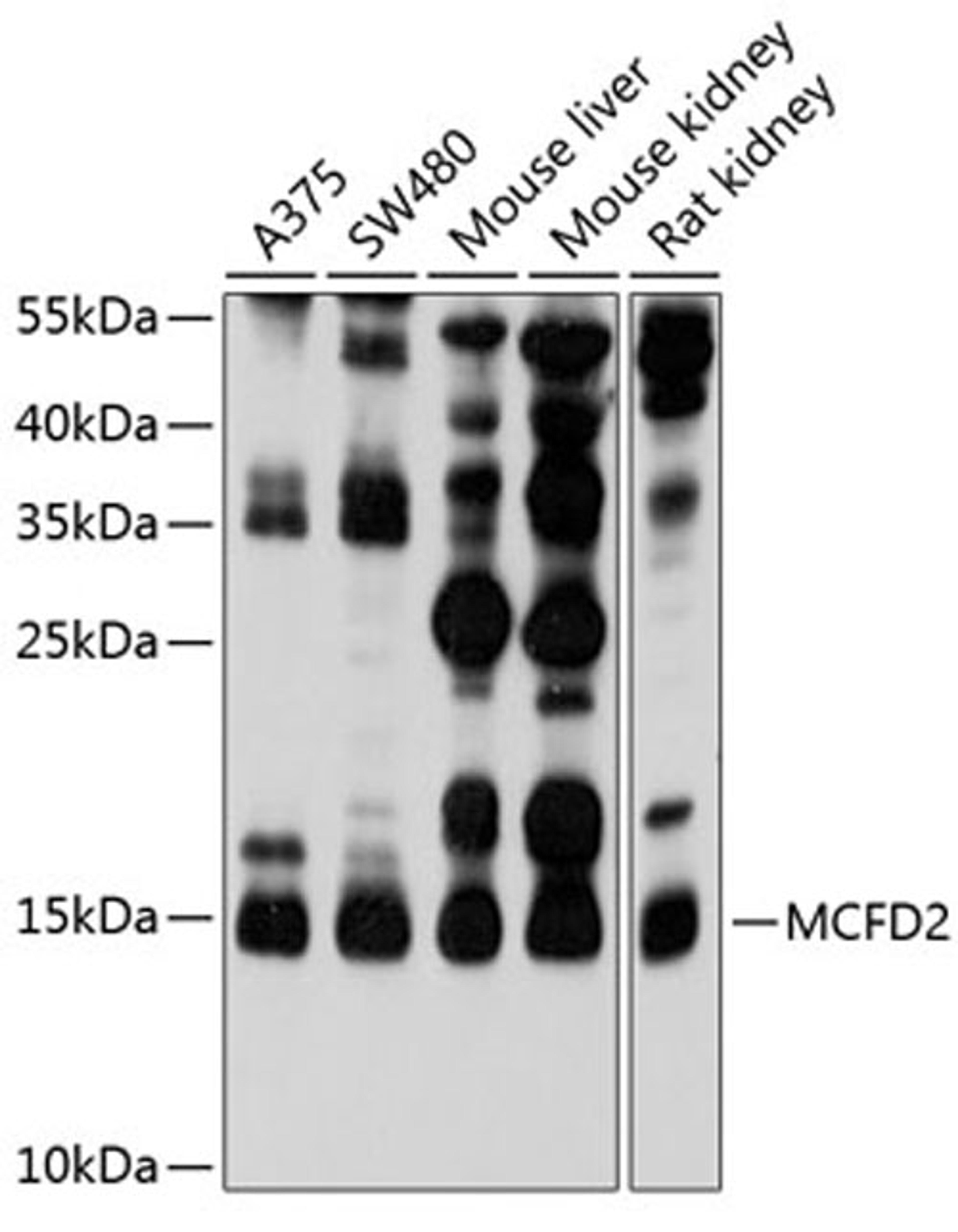 Western blot - MCFD2 antibody (A10376)