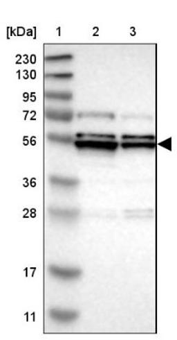 Western Blot: PRAK Antibody [NBP1-87231] - Lane 1: Marker [kDa] 230, 130, 95, 72, 56, 36, 28, 17, 11<br/>Lane 2: Human cell line RT-4<br/>Lane 3: Human cell line U-251MG sp