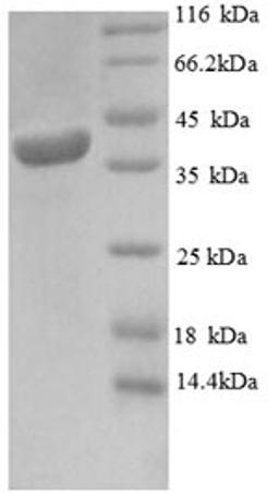 (Tris-Glycine gel) Discontinuous SDS-PAGE (reduced) with 5% enrichment gel and 15% separation gel.
