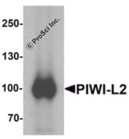 Western blot analysis of PIWI-L2 in HepG2 cell lysate with PIWI-L1 antibody at 1 μg/mL.