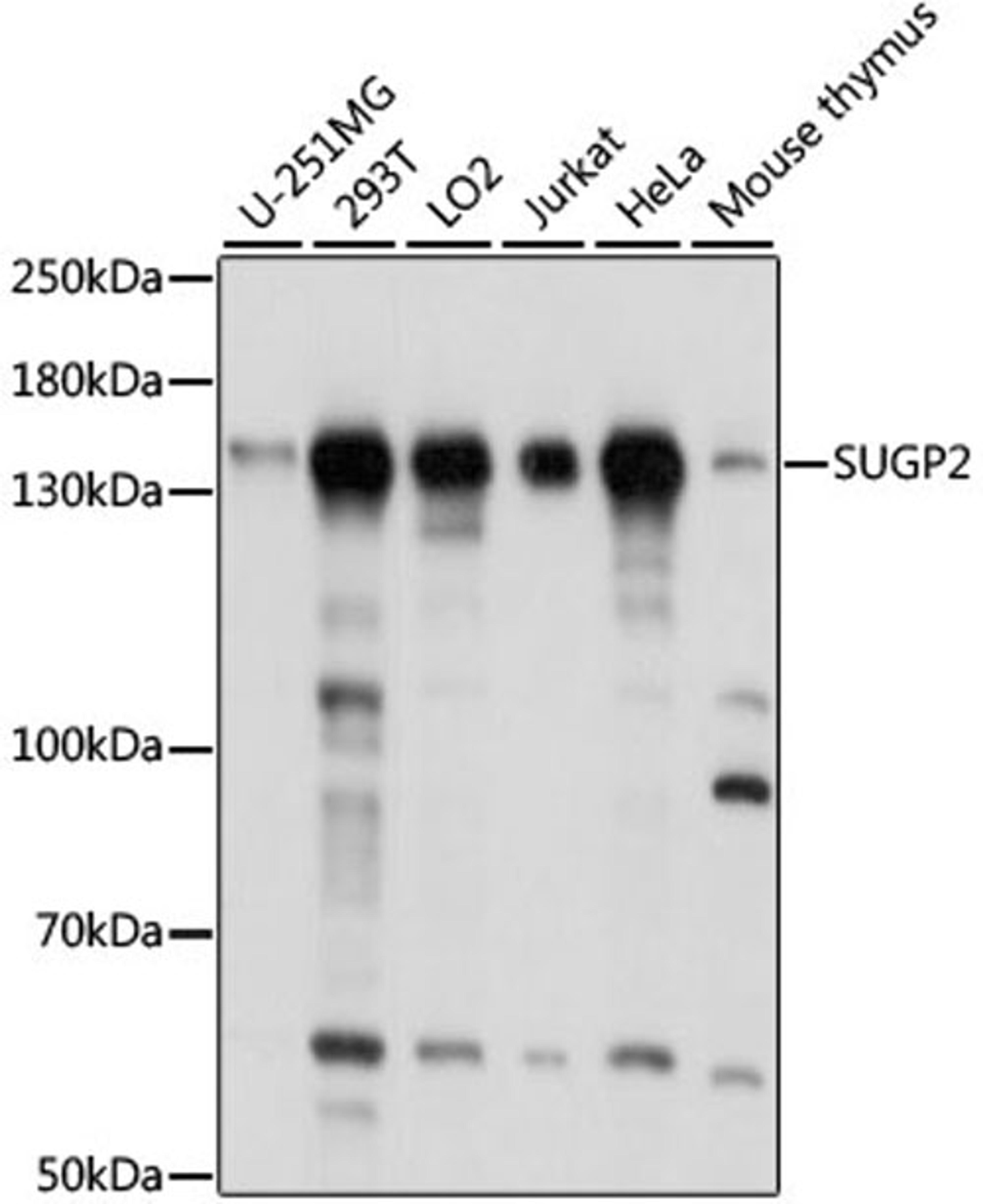 Western blot - SUGP2 antibody (A15378)