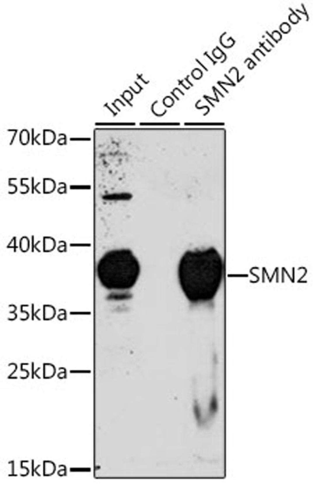 Immunoprecipitation - 3 ug SMN2 antibody (A1652)