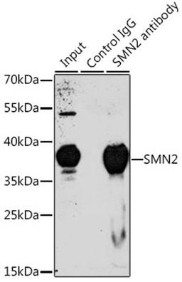 Immunoprecipitation - 3 ug SMN2 antibody (A1652)