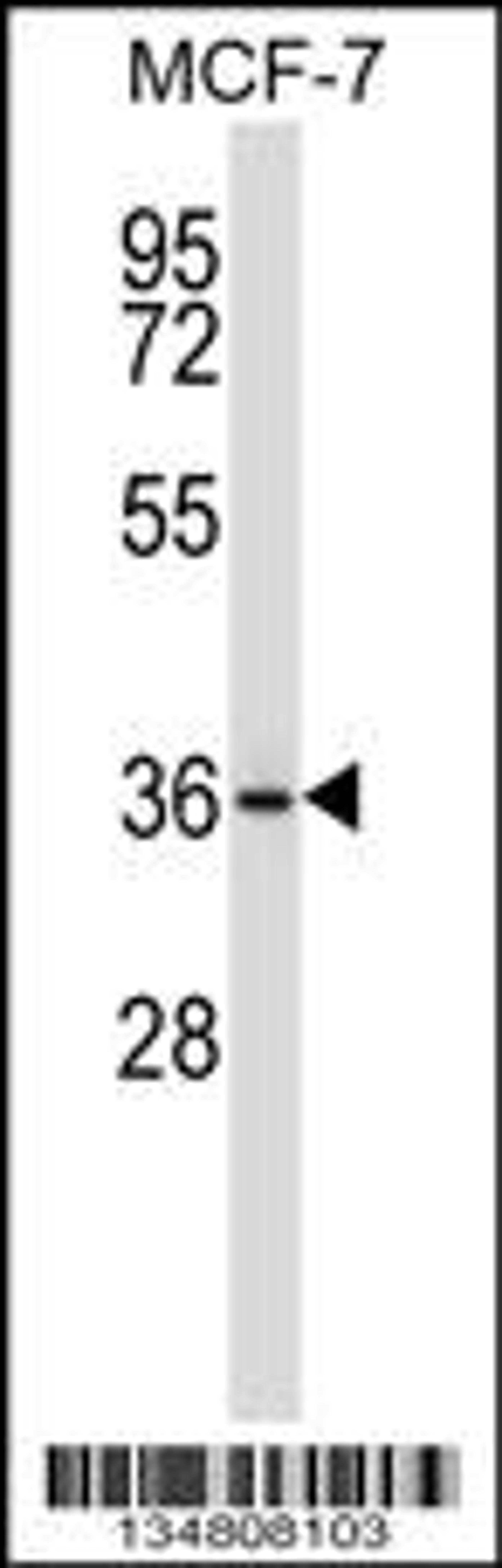 Western blot analysis in MCF-7 cell line lysates (35ug/lane).