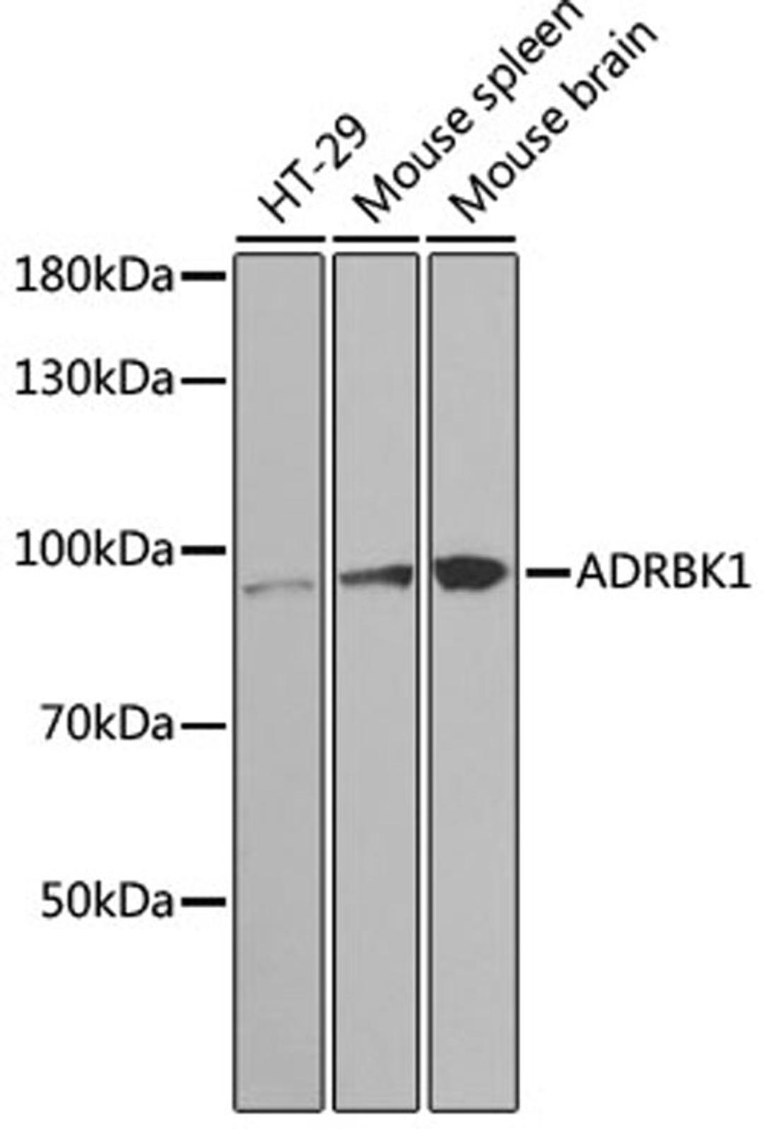 Western blot - ADRBK1 antibody (A1662)