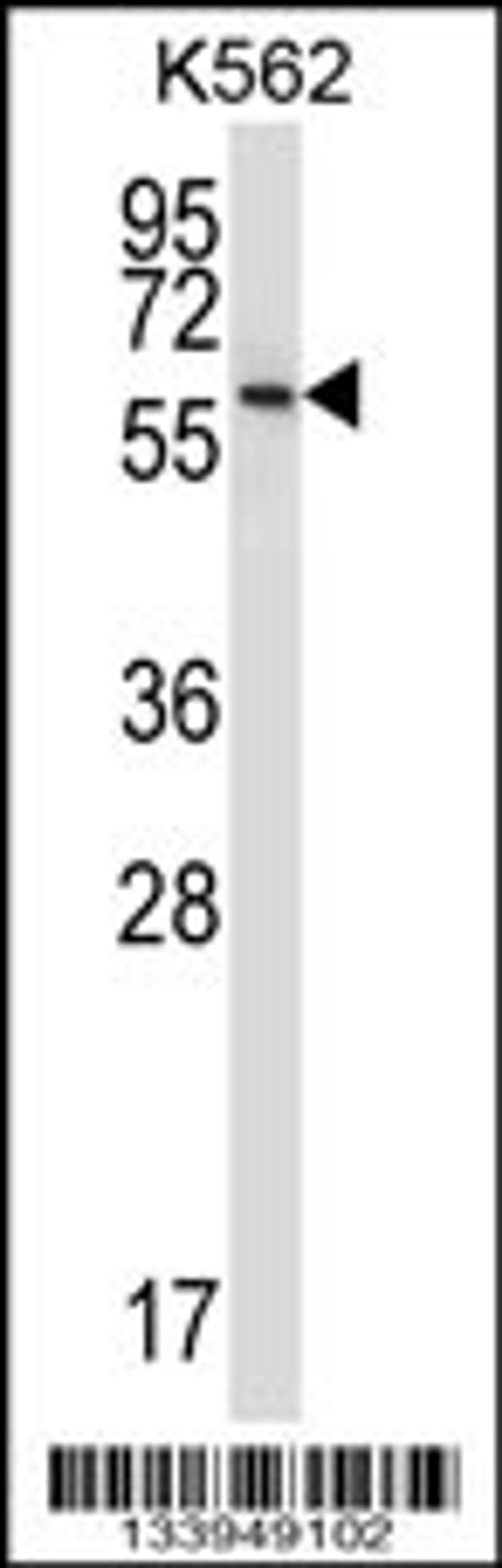 Western blot analysis in K562 cell line lysates (35ug/lane).