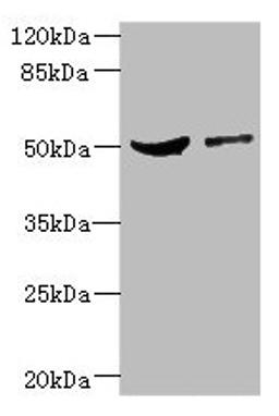 Western blot. All lanes: CPN1 antibody at 6.19µg/ml. Lane 1: Mouse liver tissue. Lane 2: MCF-7 whole cell lysate. Secondary. Goat polyclonal to rabbit IgG at 1/10000 dilution. Predicted band size: 52 kDa. Observed band size: 52 kDa
