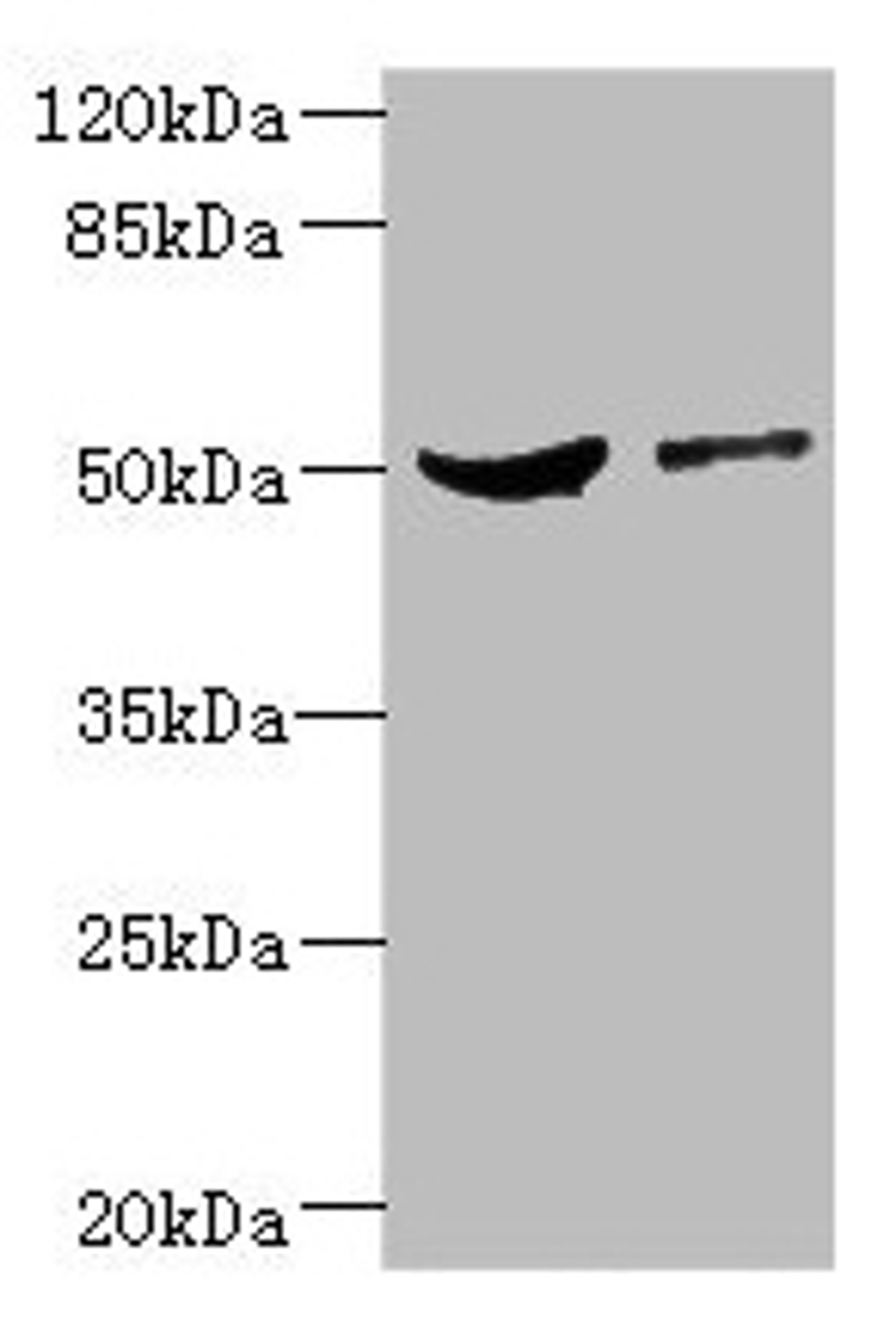 Western blot. All lanes: CPN1 antibody at 6.19µg/ml. Lane 1: Mouse liver tissue. Lane 2: MCF-7 whole cell lysate. Secondary. Goat polyclonal to rabbit IgG at 1/10000 dilution. Predicted band size: 52 kDa. Observed band size: 52 kDa