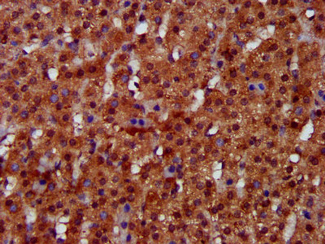 IHC image of CSB-PA847604LA01HU diluted at 1:300 and staining in paraffin-embedded human adrenal gland tissue performed on a Leica BondTM system. After dewaxing and hydration, antigen retrieval was mediated by high pressure in a citrate buffer (pH 6.0). Section was blocked with 10% normal goat serum 30min at RT. Then primary antibody (1% BSA) was incubated at 4&deg;C overnight. The primary is detected by a biotinylated secondary antibody and visualized using an HRP conjugated SP system.