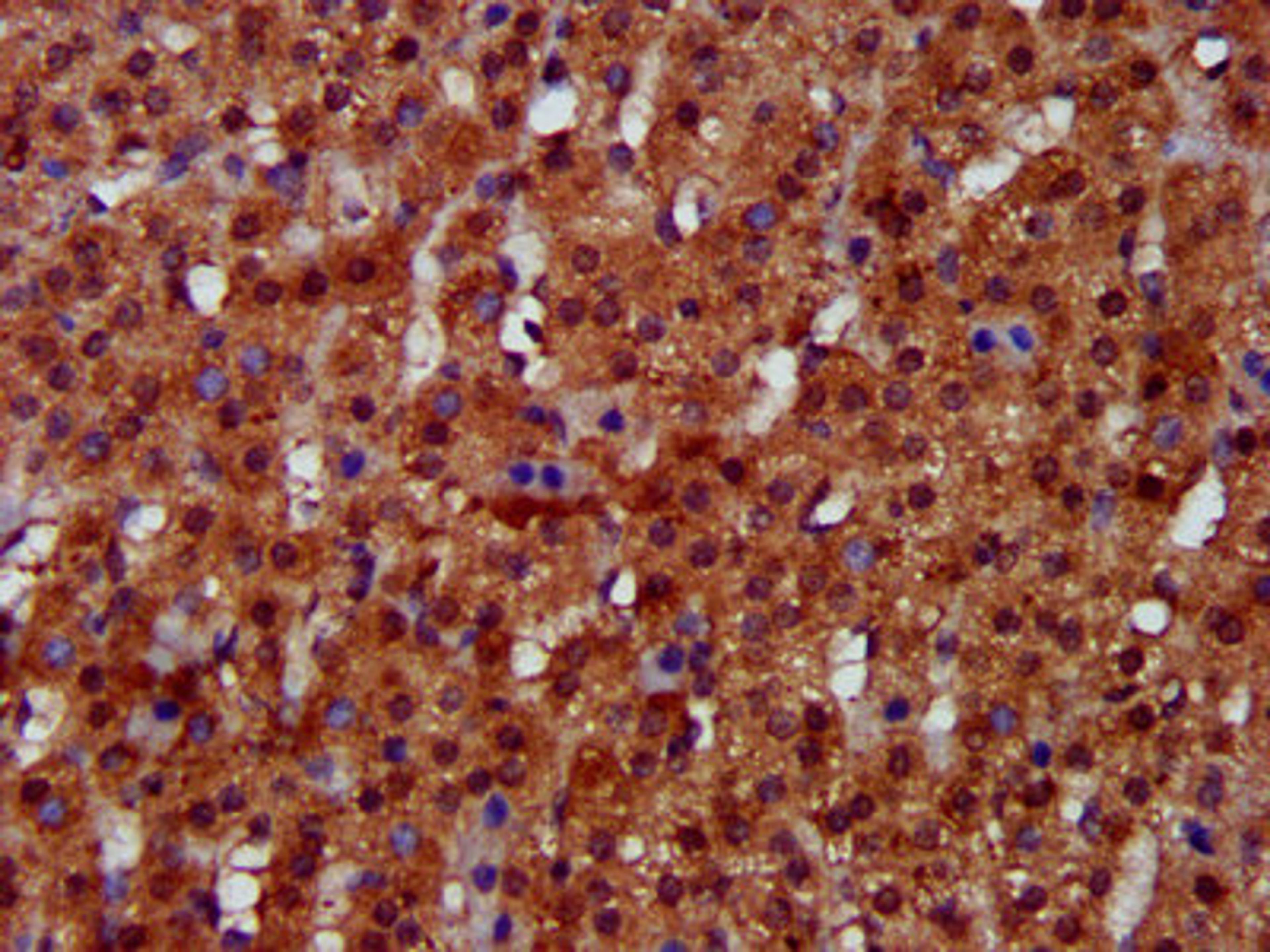 IHC image of CSB-PA847604LA01HU diluted at 1:300 and staining in paraffin-embedded human adrenal gland tissue performed on a Leica BondTM system. After dewaxing and hydration, antigen retrieval was mediated by high pressure in a citrate buffer (pH 6.0). Section was blocked with 10% normal goat serum 30min at RT. Then primary antibody (1% BSA) was incubated at 4&deg;C overnight. The primary is detected by a biotinylated secondary antibody and visualized using an HRP conjugated SP system.