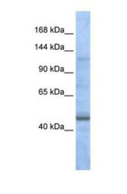 Western Blot: ASTN2 Antibody [NBP1-59195] - MCF7 tissue lysate at a concentration of 1ug/ml.