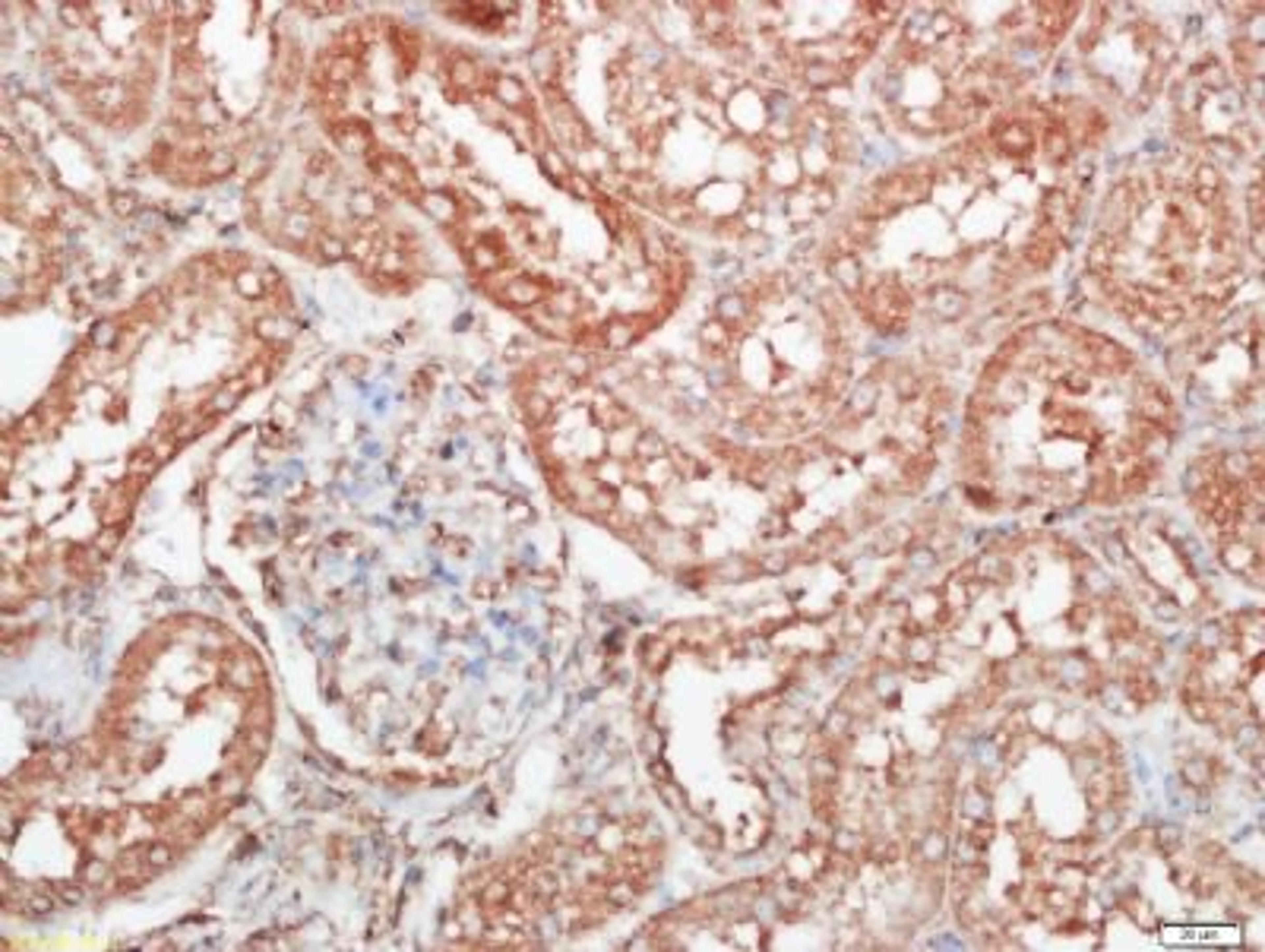 Immunohistochemical staining of rat kidney tissue using Inversin antibody.