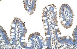 Antibody used in IHC on Human Intestine.