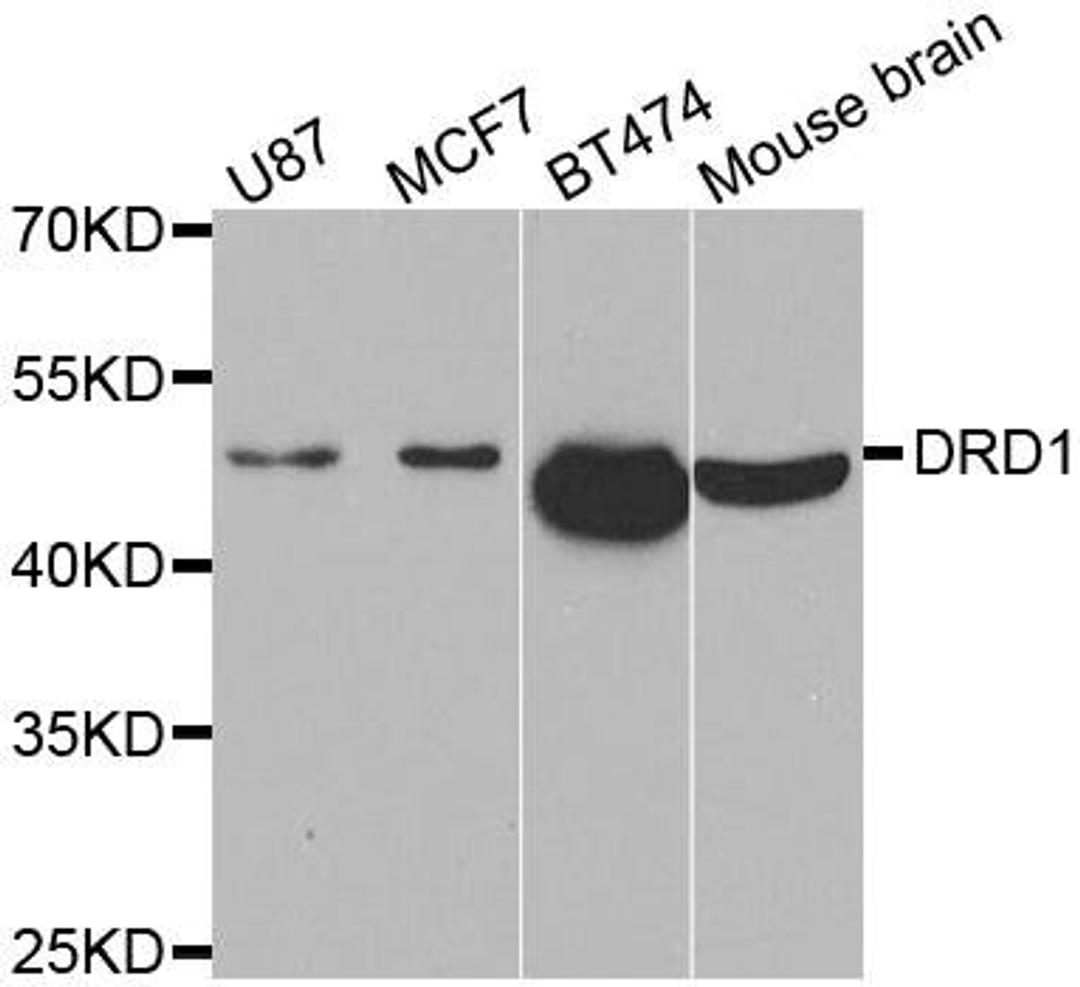 Western blot analysis of extracts of various cell lines using DRD1 antibody