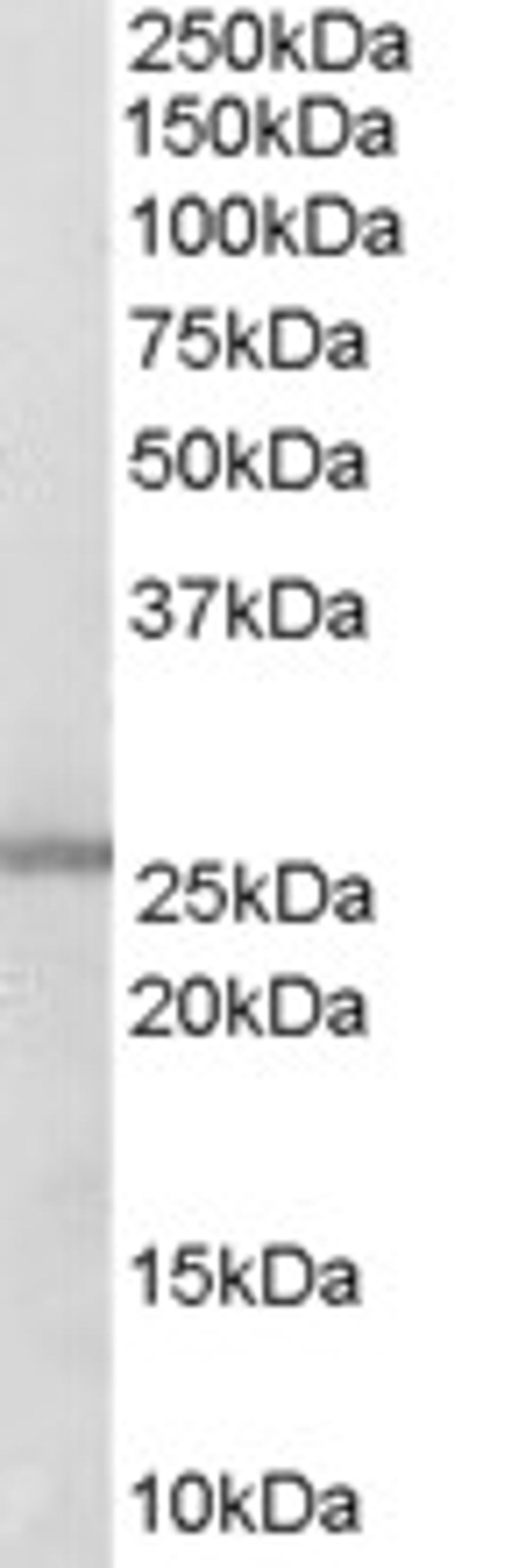 45-712 (0.3ug/ml) staining of Human Lung lysate (35ug protein in RIPA buffer). Primary incubation was 1 hour. Detected by chemiluminescence.