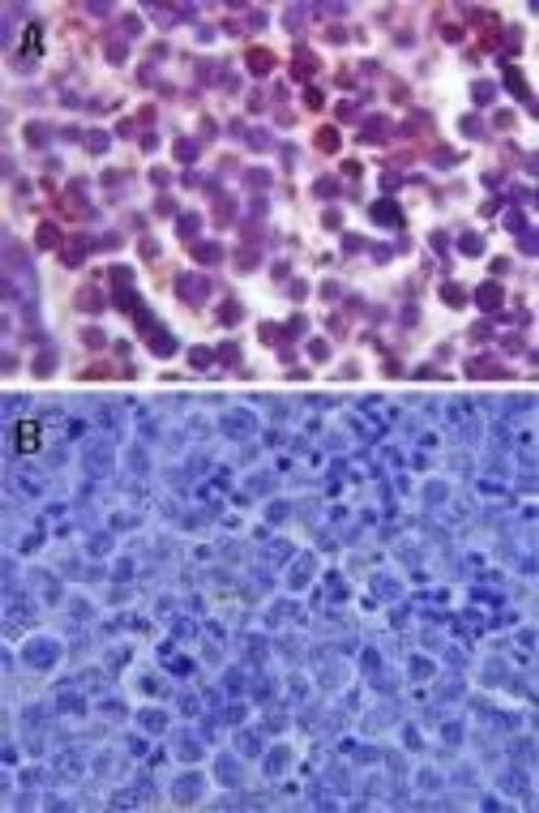 Immunohistochemistry-Paraffin: TLR4 Antibody [NB100-56581] - Analysis of TLR4 in formalin-fixed, paraffin-embedded mouse spleen tissue using NB100-56581 (A) and mouse isotype control (B) at 5 mg/ml.