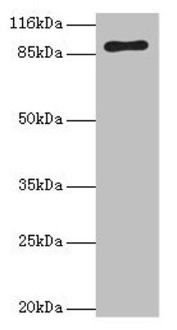 Western blot. All lanes: RRM1 antibody at 2µg/ml + Hela whole cell lysate. Secondary. Goat polyclonal to rabbit IgG at 1/10000 dilution. Predicted band size: 91 kDa. Observed band size: 91 kDa