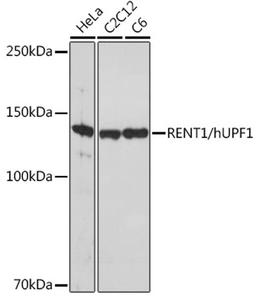 Western blot - RENT1/hUPF1 Rabbit mAb (A5071)