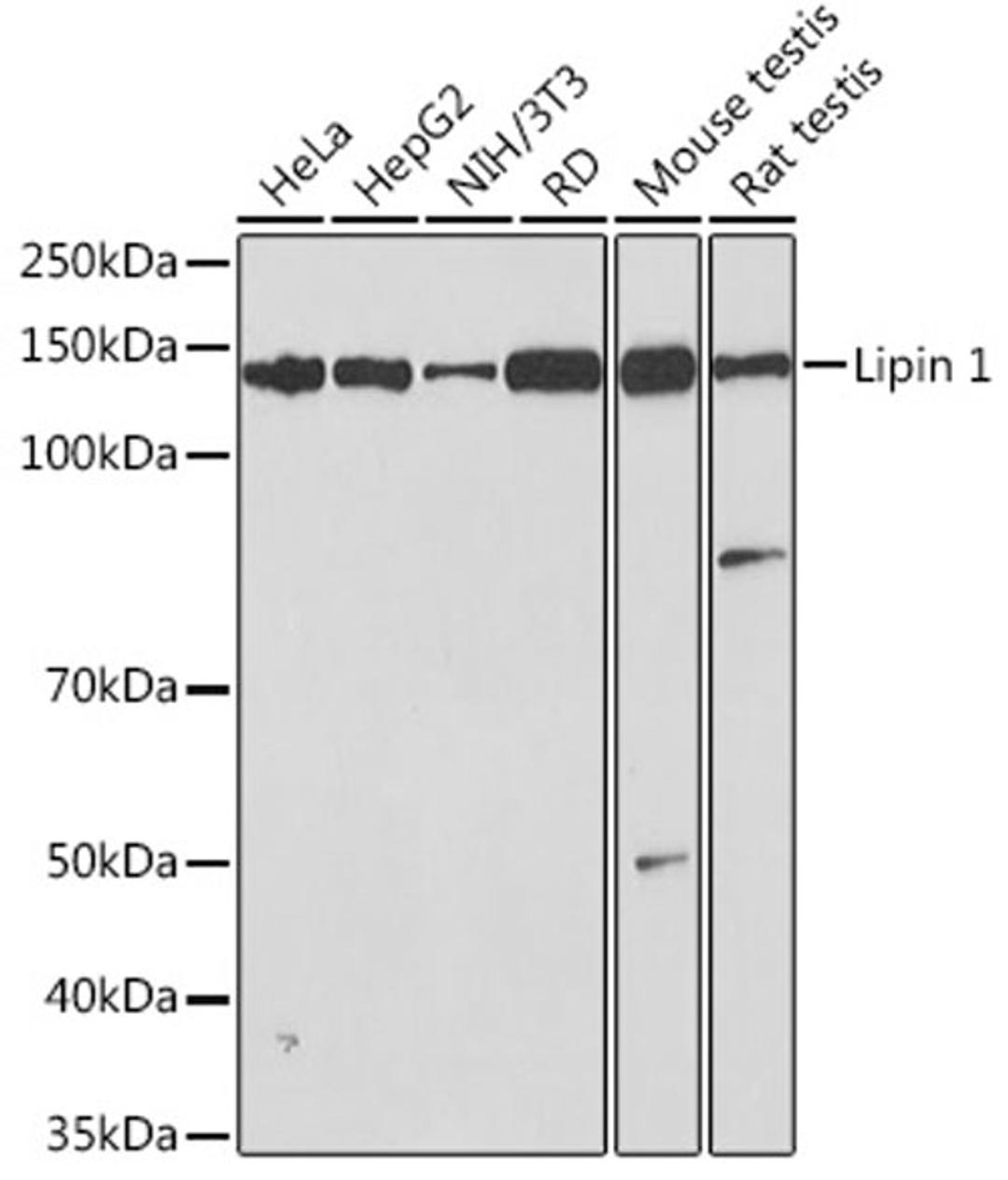 Western blot - Lipin 1 Rabbit mAb (A3326)