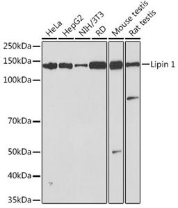 Western blot - Lipin 1 Rabbit mAb (A3326)
