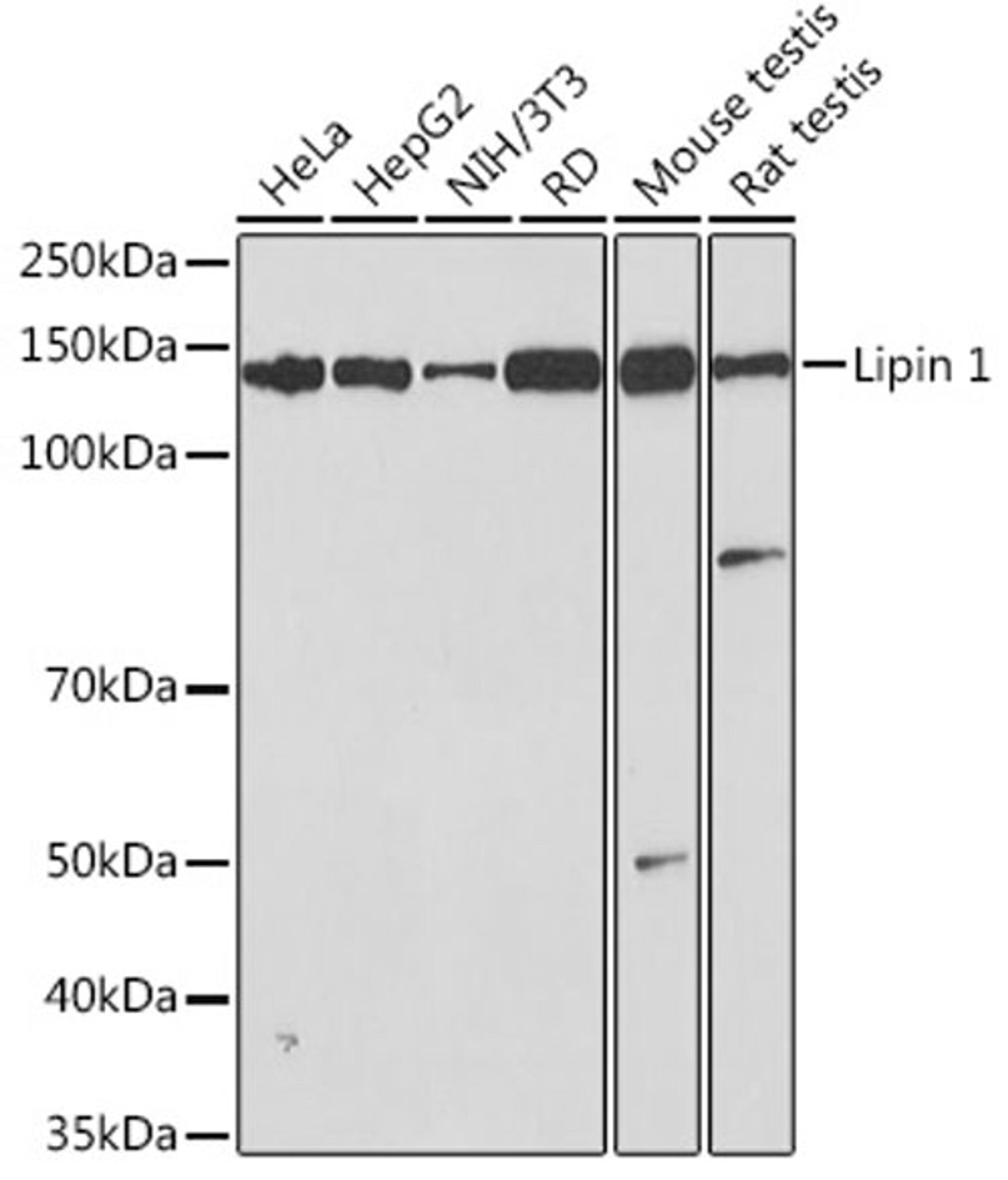 Western blot - Lipin 1 Rabbit mAb (A3326)
