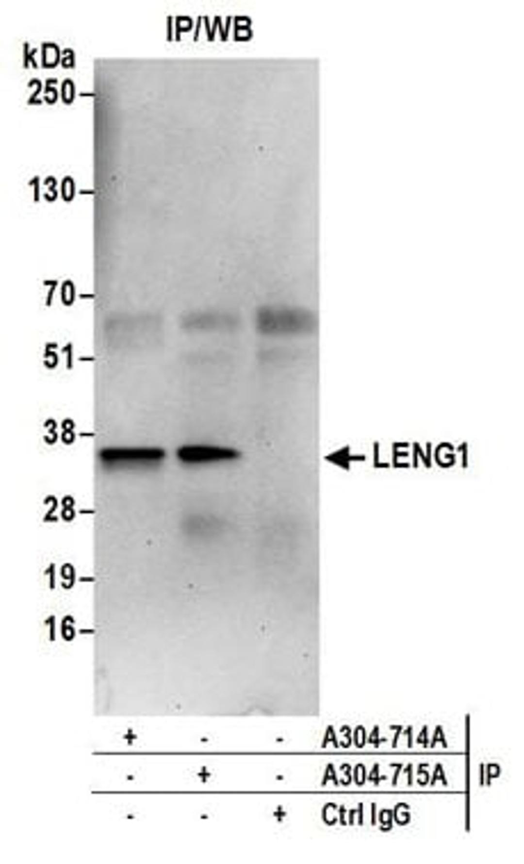 Detection of human LENG1 by western blot of immunoprecipitates.