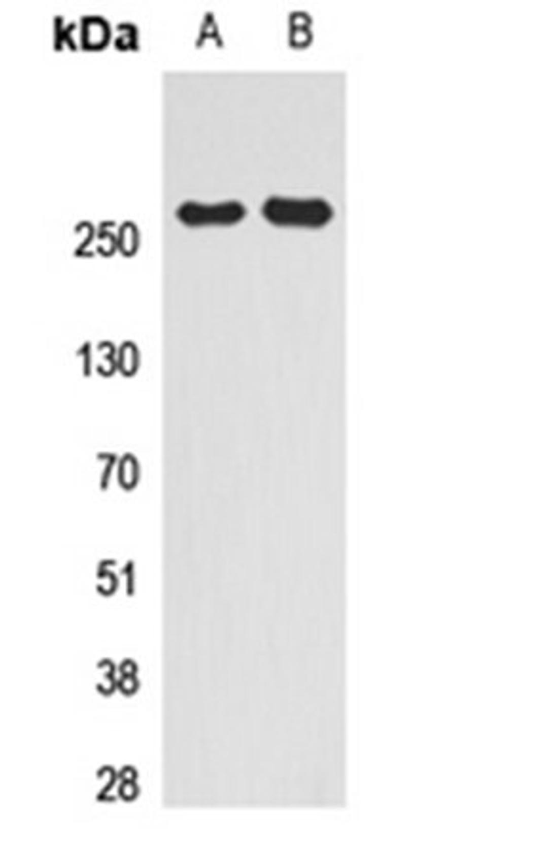 Western blot analysis of HeLa (Lane 1), HEK293T (Lane 2) whole cell lysates using SMRT antibody