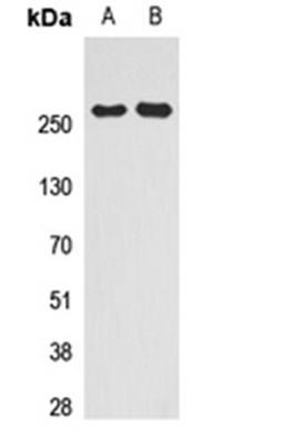 Western blot analysis of HeLa (Lane 1), HEK293T (Lane 2) whole cell lysates using SMRT antibody