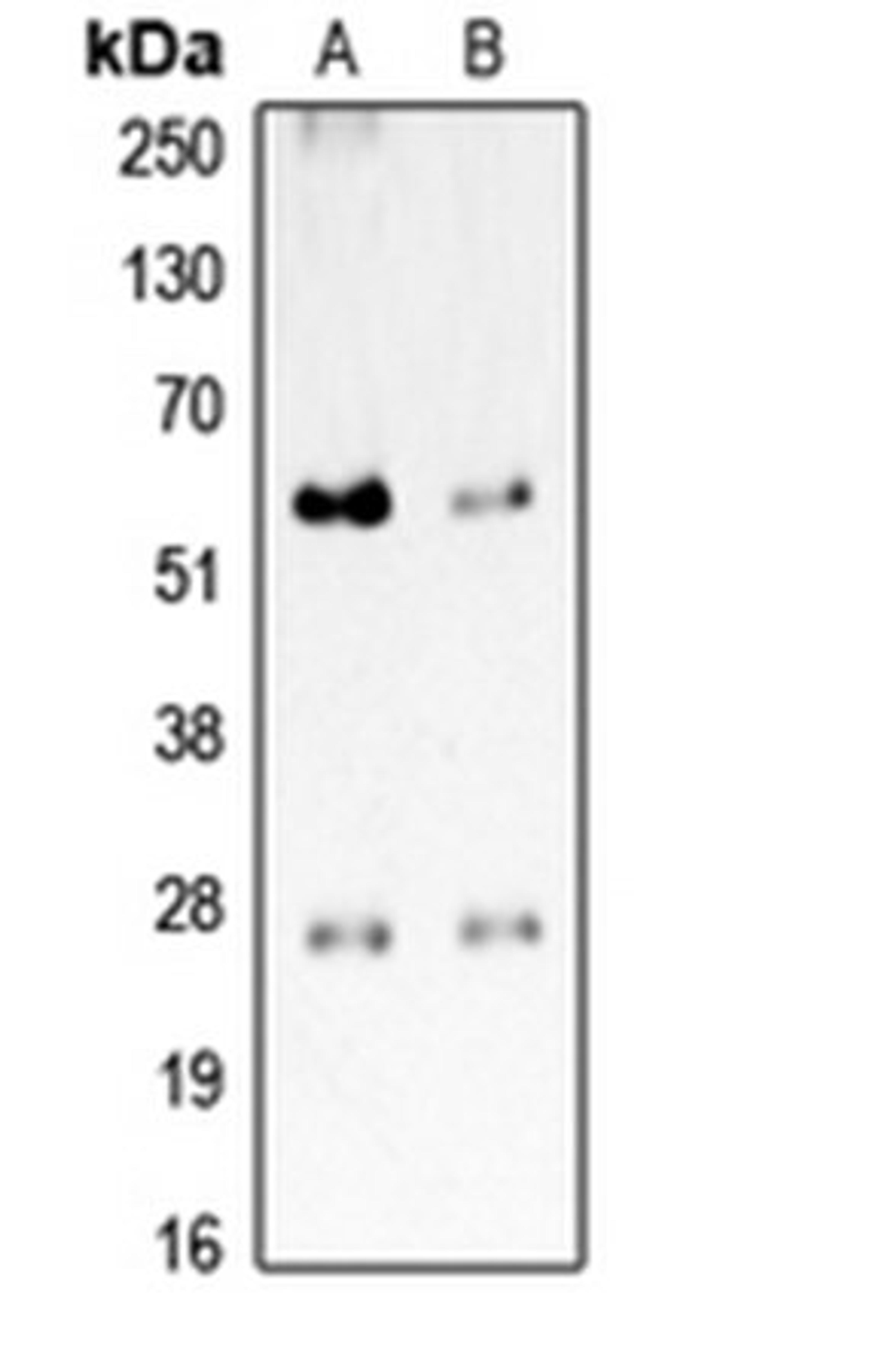 Western blot analysis of HeLa (Lane 1), rat brain (Lane 2) whole cell lysates using CD201 antibody