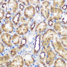 Immunohistochemistry  - WWC2 Rabbit pAb (A18668)